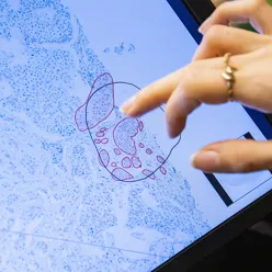 Foto: Person peker på skjerm med bilde